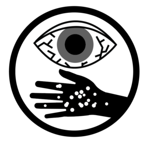 Icon of a bloodshot eye and hand with spots on it depicting the concept of irritation to the eyes or skin