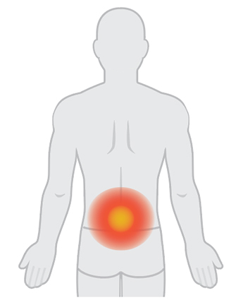 ergo_symptoms_1